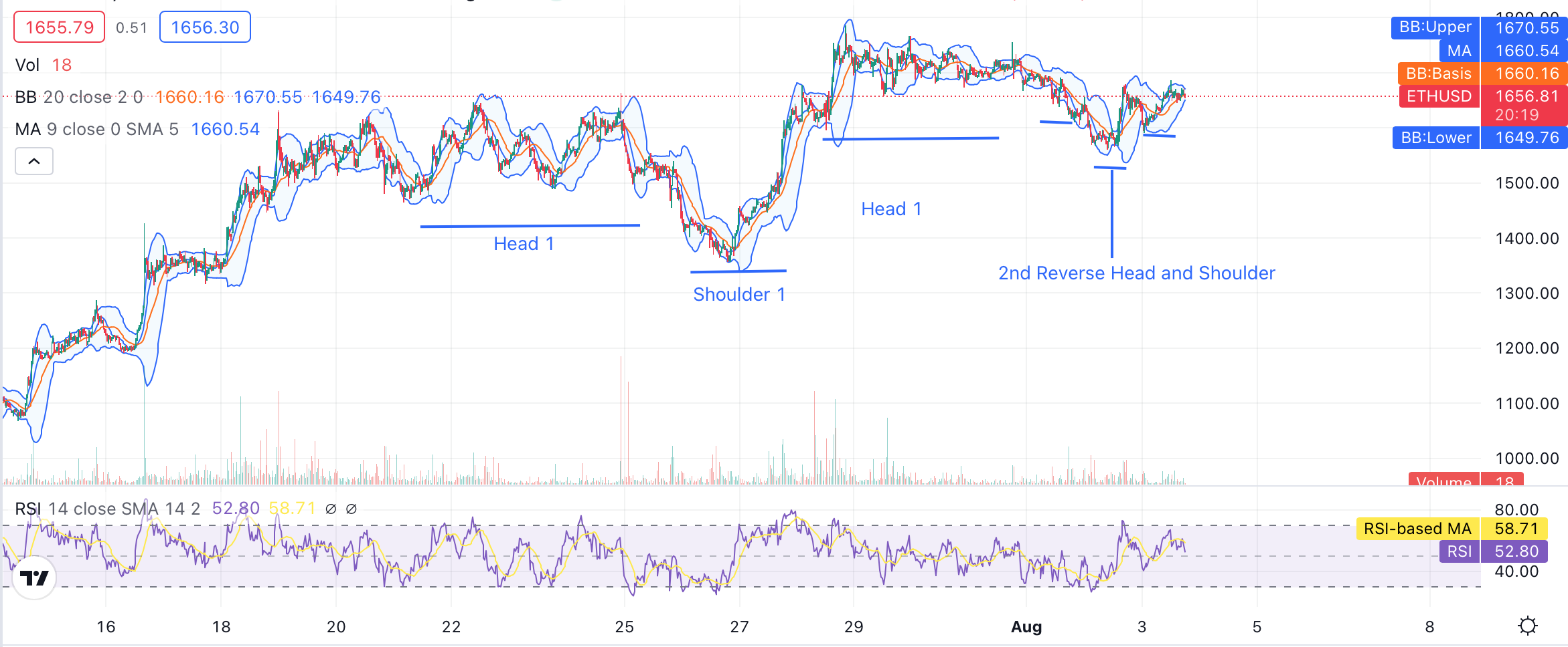 Ethereum price analysis - Reverse Head and Shoulder - 3rd August 2022-
